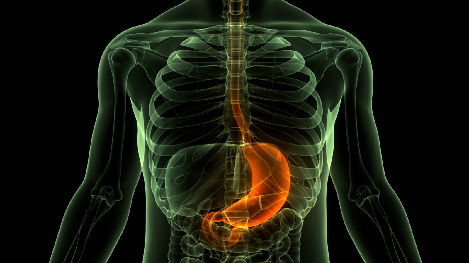 Diéta vagy gyomorszűkítő műtétek  - gyomorszűkítés ára